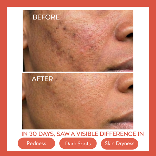 Hydrating Dew Moisturizer