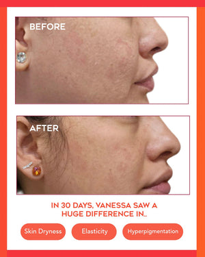 Hydrating Dew Moisturizer