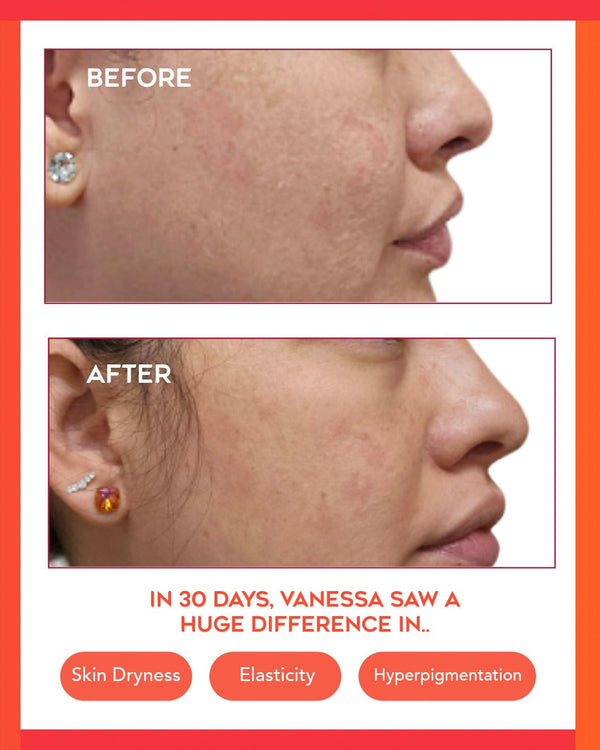 Hydrating Dew Moisturizer