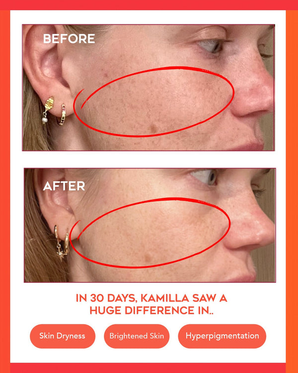 Hydrating Dew Moisturizer