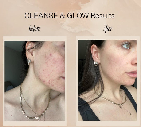 CLEANSE & GLOW Set