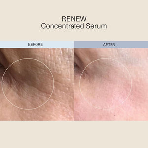 RENEW Concentrated Serum