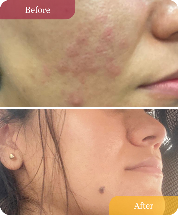 Clear Confidence Moisturizer