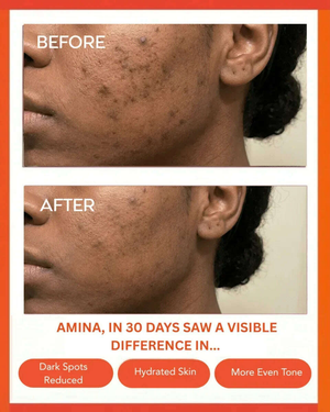 Clear Confidence Moisturizer