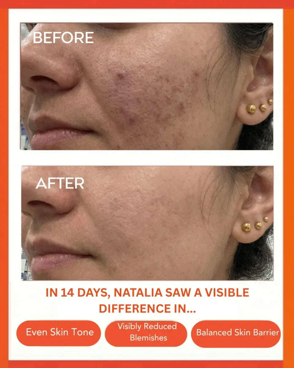 Clear Confidence Moisturizer