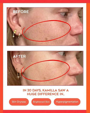 Hydrating Dew Moisturizer