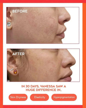 Hydrating Dew Moisturizer