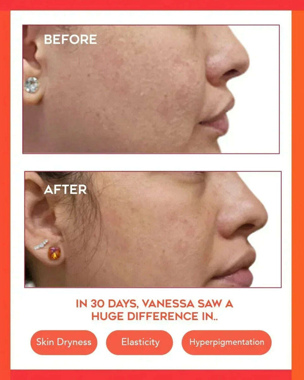 Hydrating Dew Moisturizer