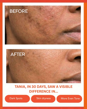 Hydrating Dew Moisturizer