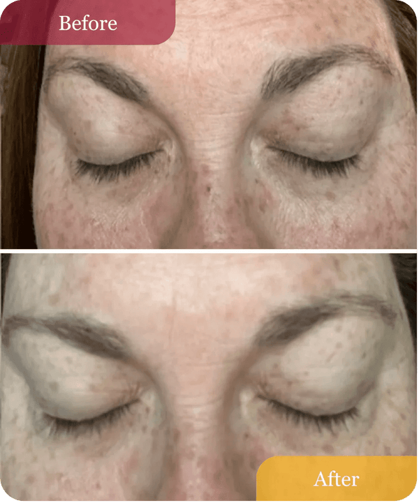 Hydrating Dew Moisturizer