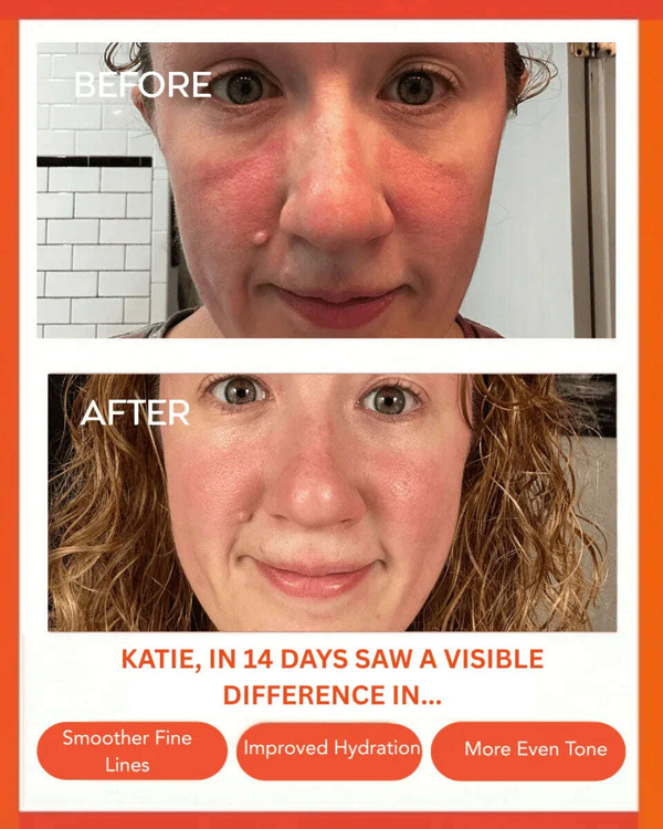 Hydrating Dew Moisturizer