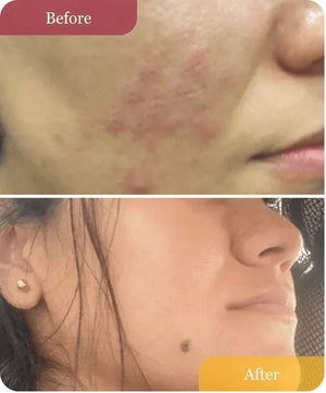 Clear Confidence Moisturizer