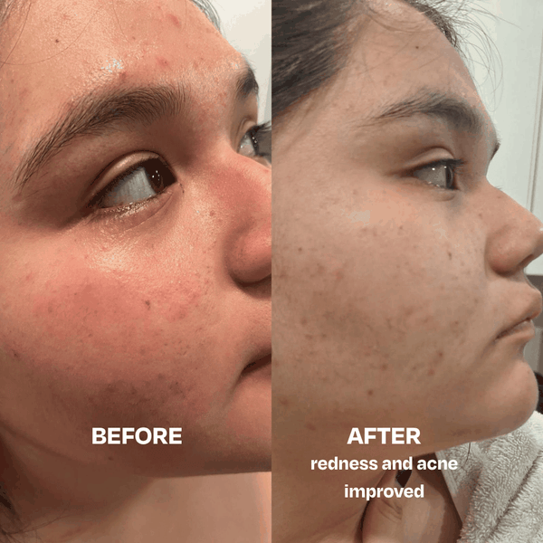 Skin Saver